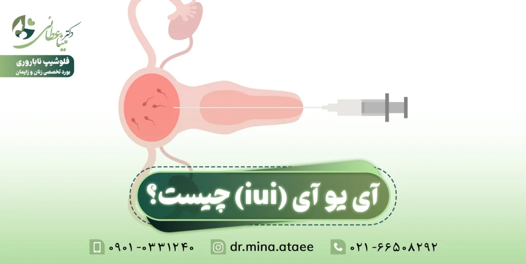 آی یو آی iui چیست؟