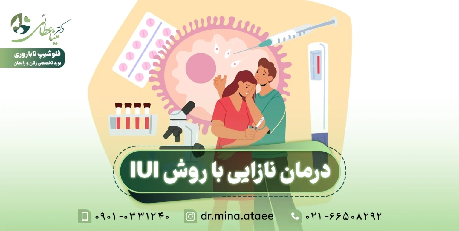درمان نازایی با روش iui